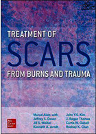 Treatment of Scars from Burns and Trauma2021درمان اسکار ناشی از سوختگی و تروما